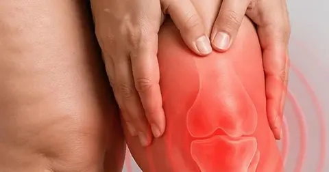Diz biyomekaniğini bozan süreç: Lipödem